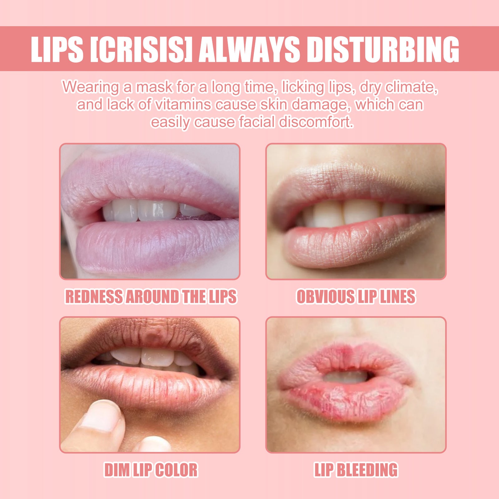 EELHOE Lip Mask Lightening Lip Lines, Hydrating, Moisturizing, Removing Dead Skin, Anti-Freezing And Cracking, Non-Greasy And Easy To Absorb Lip Balm